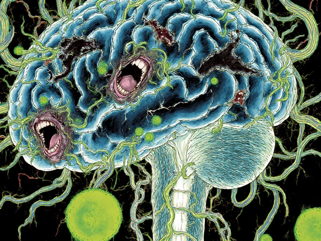 Sclérose en plaques : quand le système immunitaire attaque le système nerveux